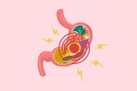 Un símbolo de malestar se dibuja alrededor de un estómago lleno de comida.